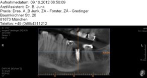 Zahnarzt München strahlenarmes Röntgengerät