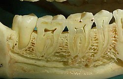 Zahnarzt München: warum ist ein toter Zahn oft schmerzhaft